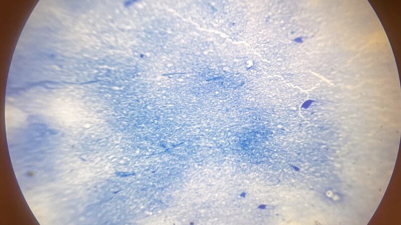 Protein That Senses Fibre Size Helps Set Myelin Segment Length